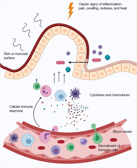 Inflammation | Bio-Rad Adaptive Immune System, Get Thick, Signs Of Inflammation, Systemic Inflammation, C Reactive Protein, Cells And Tissues, Ketosis Diet, Viral Infection, Medical Art