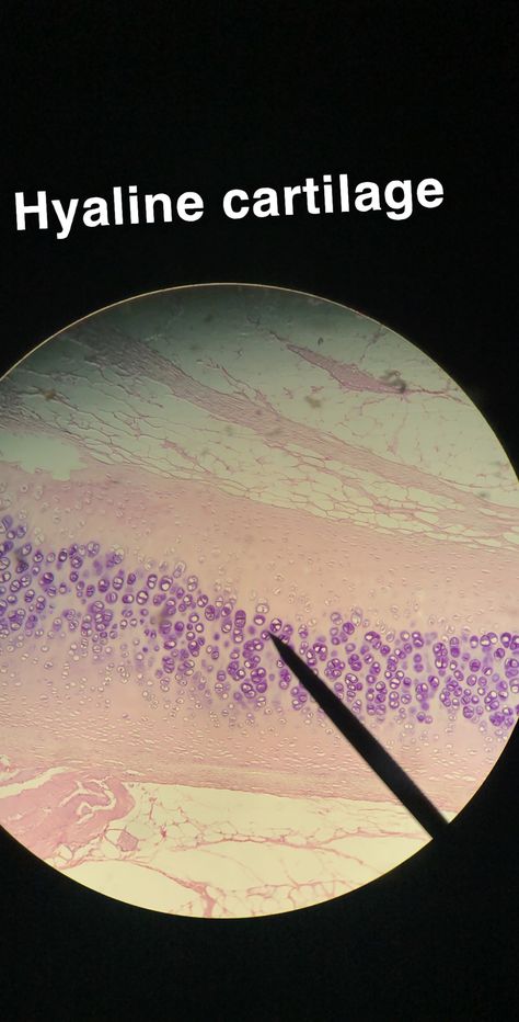 found in the ends of bones and in the trachea. this cartilage provides support and flexibility. you can identify these by looking for a group of lacunae surrounded by smooth collagenous and elastic fibers. Physiology Flashcards, Hyaline Cartilage, Anatomy And Physiology, A Group, Anatomy, Bones, Medical, Elastic, Quick Saves