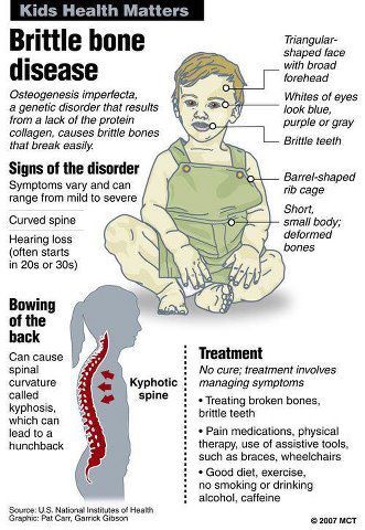 Brittle Bone Disease Collagen Products, Osteogenesis Imperfecta, Physical Therapist Assistant, Bone Diseases, Natural Collagen, Musculoskeletal System, Genetic Disorders, Nursing Notes, Pediatric Nursing