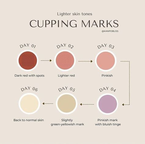 Cupping Therapy Color Chart, Hijama Points Sunnah, Cupping Therapy Aesthetic, Hijama Points, Cupping Points, Body Cupping, Hijama Cupping, Massage Marketing, Massage Logo