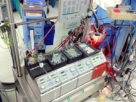 Heart-lung machine Heart Lung Machine, Cardiac Perfusionist, Nursing Terminology, Smaller Nose, Reading Area, Heart Surgery, Med Student, Medical Devices, Study Motivation Inspiration