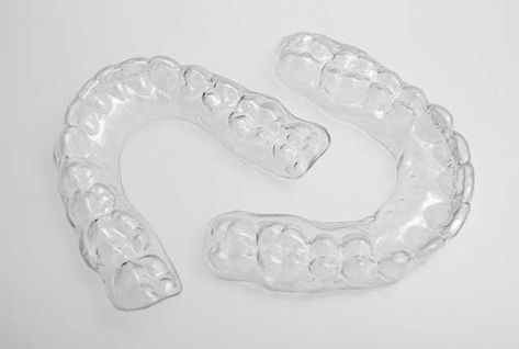 Cleaning and Caring for Clear Retainers  http://www.dentistryondusk.com/cleaning-caring-clear-retainers/ Hawley Retainer, Permanent Retainer, Retainer Teeth, Clear Retainers, Dental Retainer, Teeth Alignment, Clear Aligners, Grinding Teeth, Braces