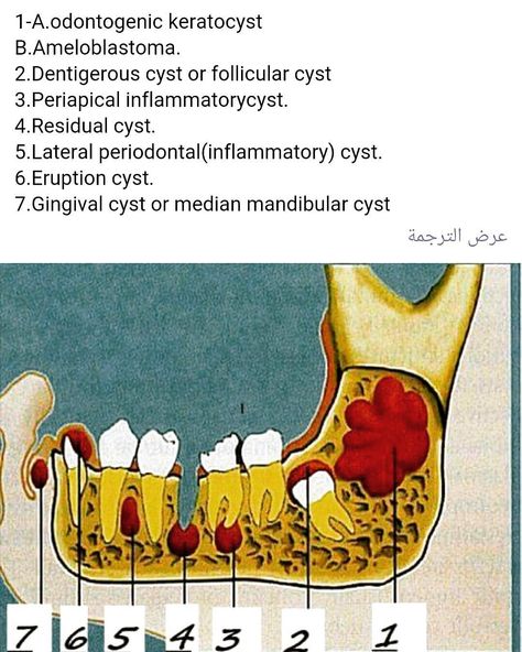 #odonto #odontologia #odontology #perio #periodontology #orthodontia… Dental Assistant Study, Oral Pathology, Dental Hygiene Student, Dental World, Dental Posts, Dental Hygiene School, Dentistry Student, Dental Anatomy, Dental Fun