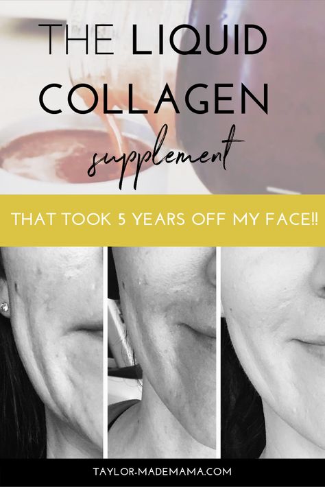 Increase Collagen Production, Rejuvicare Collagen, Liquid Collagen Products, Liquid Collagen Before And After, Best Collagen For Women, Liquid Collagen Benefits, Best Liquid Collagen, Modere Collagen, Modere Trim