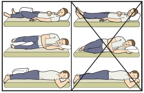 Figure 9. Sleeping positions after a hip replacement Anterior Hip Surgery, Total Hip Surgery, Hip Surgery Recovery Tips, Labral Tear Hip Surgery Recovery, Exercises After Hip Surgery, Hip Precautions, Hip Dislocation, Hip Surgery Recovery, Bursitis Hip