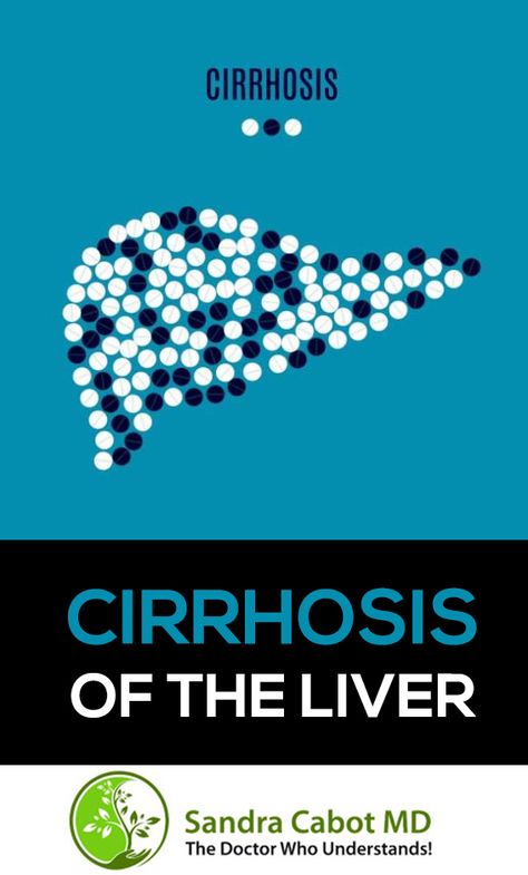 Cirrhosis of the liver is the term used to describe liver disease where chronic inflammation of liver cells has caused an extensive and widespread build up of scar tissue in the liver. Chirosis Of The Liver Diet, Food Good For Liver, Quadrants Of The Abdomen, Liver Cleanse Juice, Disease Quote, Liver Damage, Kidney Detox, Liver Diet, Feminine Health