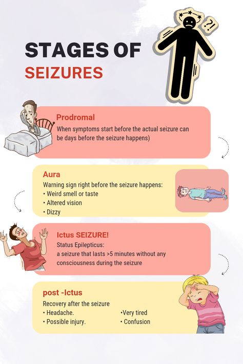 Understanding the Different Stages of Seizures Non Epileptic Seizures, Seizures Nursing, Focal Seizures, Medical Essentials, Simple Nursing, Types Of Seizures, Seizures Awareness, Medical Study, Cleansing Drinks