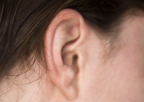 How to Treat an Itchy Ear Canal Itchy Ears Remedies Allergies, Itchy Ears Remedies, Itchy Ear, Itching Remedies, Earache Remedies, Health Reminders, Healing Ideas, Organic Medicine, Inside Ear