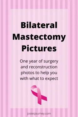 Radiation After Mastectomy, Double Mastectomy Without Reconstruction, Bilateral Mastectomy Tattoo, Preventative Double Mastectomy, Brca2 Tattoo, Mastectomy Cookies, Prophylactic Bilateral Mastectomy, Mastectomy Recovery Must Haves, Double Mastectomy Recovery