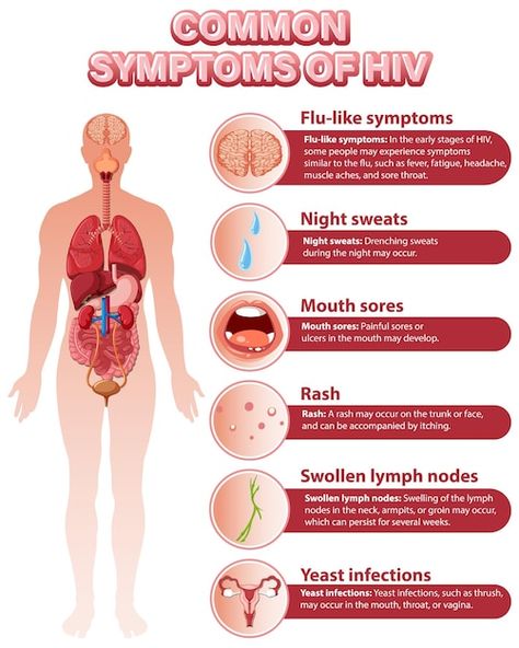 Informative poster of common symptoms of... | Free Vector #Freepik #freevector #physiology #anatomy #science-cartoon #human-anatomy Poster Hiv, Hiv Poster, Symptoms Of Hiv, Informative Poster, Hiv Symptoms, Anatomy Science, Capstone Project Ideas, Cartoon Human, Aids Hiv