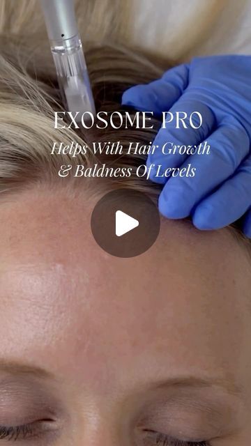 Exosome Therapy, Aesthetic Treatments, Skin Pigmentation, Vibrant Hair, Iv Therapy, Wrinkle Reduction, Stretch Mark, Hair Follicle, Our Body