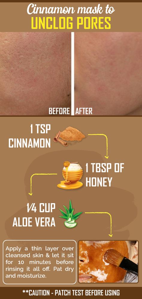 Face Mask For Clogged Pores, Unclog Pores On Face Diy, Diy Face Mask To Unclog Pores, How To Get Rid Of Clogged Pores, Pores On Face How To Get Rid Of, Face Hacks, Face Remedies, Dry Oily Skin, Diy Masks