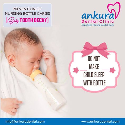 Prevention Of Nursing Bottle Caries(BABY Tooth Decay):  ☛ Do Not make child sleep with bottle.  #BabyCare #BabyTeeth #Baby #MilkBottle Wisdom Teeth Funny, Baby Tooth Decay, Dental Surgery Food, Family Dental Care, Teeth Whitening Homemade, Nursing Bottle, Black Teeth, Dentistry Student, Child Sleep