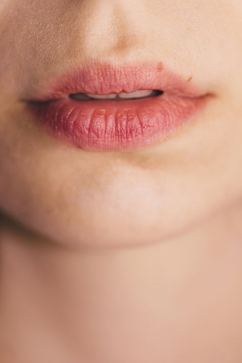 Lips tend to become easily chapped because they don’t contain oil or sweat glands like the rest of your body. Learn more about chemical lip peels. Abdominal Stretches, Lips Peeling, Moon Lee, Skin Bumps, Sweat Gland, Lip Exfoliator, Smooth Lips, Exfoliate Face, Alpha Hydroxy Acid