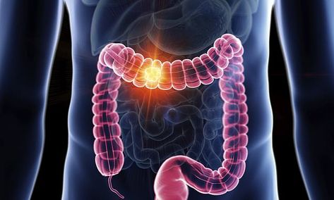 Medical Oncology, Metabolic Disorders, Large Intestine, Types Of Cancers, Gut Health, Energy