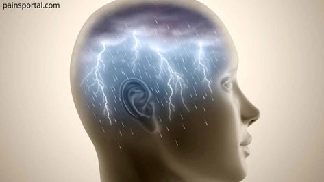 Thunderclap Headache - Location, Causes and Prevention - Pains Portal Headache Location, Whiplash Injury, Subarachnoid Hemorrhage, Bad Headache, Severe Headache, Stomach Pain, Do Exercise, Blood Vessels, Headache