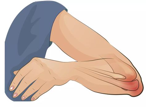 Elbow Pain Relief Exercise, Elbow Bursitis, Bursitis Exercises, Bursitis Elbow, Forearm Anatomy, Tennis Elbow Relief, Elbow Pain Relief, Osteoporosis Exercises, Dry Elbows