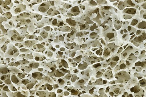 bone | Flickr - Photo Sharing! Cancellous Bone, Human Tissue, Future Buildings, Microscopic Images, Human Bones, Texture Seamless, Skeletal, Patterns In Nature, Color Textures