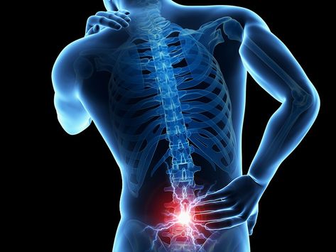 South Charlotte Chiropractic clinic treating patients for neck pain and lower back pain. Sistem Saraf, Bolesti Chrbta, Chronic Lower Back Pain, Spine Pain, Chiropractic Clinic, Essential Oils For Pain, Spine Surgery, Sciatic Nerve Pain, Sciatica Pain