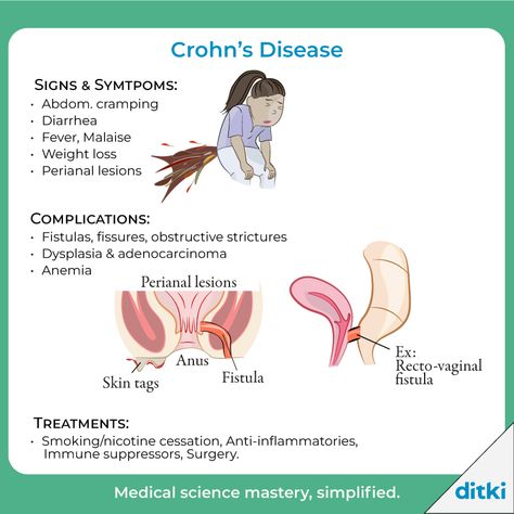 What are some extraintestinal presentations of CD?  Learn more: https://ditki.com/course/gastrointestinal-system/pathology/inflammatory-bowel-disease/1715/inflammatory-bowel-disease  #ditki #usmle #meded #medschool #medstudent #highered #crohns #GIpathology #pathology #nursing #pance #physicianassistant #osteopath #allopath #medicine #science #healthscience #nurse #premed #mcat #mbbs Intestinal Inflammation, Crohns Diet, Nurse Study, Autoimmune Disorders, Gastrointestinal Disease, Inflammatory Bowel, Gastrointestinal System, Nurse Study Notes, Gastrointestinal Disorders