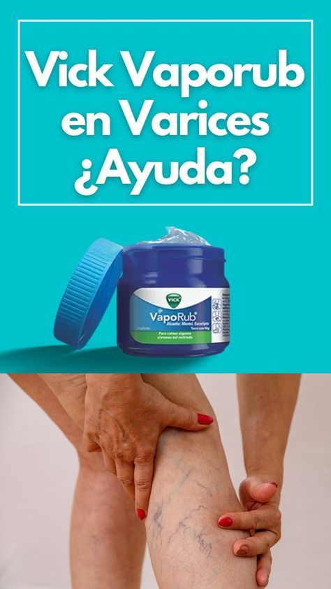 En este artículo explican si realmente ayuda o no poner Vick Vaporub sobre las varices. Existen muchas recetas caseras en internet que incluyen Vick Vaporub. En este artículo explican y develan la verdad. Vic Vaporub, Apple Cider Vinegar Recipes, Vicks Vaporub Uses, Uses For Vicks, Holistic Health Remedies, Women Health Care, Healthy Morning Routine, Vicks Vaporub, Body Awareness