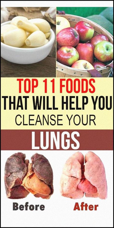 Health Resolutions, Magnesium Rich Foods, Lungs Health, Diy Health, Lungs, Health Info, Natural Medicine, Natural Living, Herbal Remedies