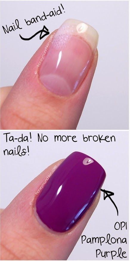 Popular Diy Crafts, Broken Toenail, Fix Broken Nail, Repair Broken Nail, Fingernail Health, Split Nails, Broken Finger, Popular Diy, Hard Nails