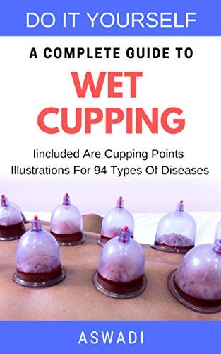 Do it yourself - a complete guide to wet cupping: Iincluded Are Cupping Points Illustrations For 94 Types Of Diseases The book includes: •The history of cupping  •What is cupping?  •Benefits and advantages of cupping  •Frequently ask questions  •Do and don’t in cupping. •Tools you must have before do cupping Cupping Placement Chart, Wet Cupping Therapy, Cupping Benefits, Hijama Points, Cupping Points, Wet Cupping, Chinese Cupping, Benefits Of Cupping, Hijama Cupping