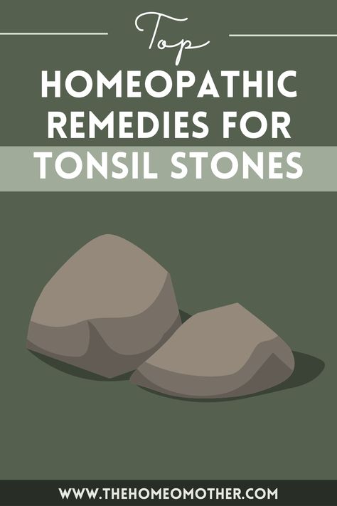 Top Homeopathic Remedies for Tonsil Stones Tonsil Stone Remedies, Tonsil Stone Removal, Tonsil Stone, Hard Breathing, Canker Sore, Homeopathic Remedies, Homeopathy, Medical Advice, Home Remedies