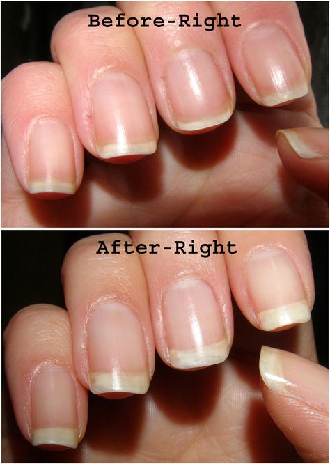 Nail Envy Before and After Nail Envy Opi, Opi Nail Envy, Nail Growth, Nail Envy, Makeup Tricks, Nail Strengthener, Opi Nails, Beautiful Skin, Diy Beauty