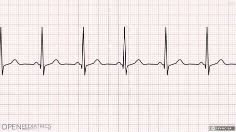 Sinus Rhythm, Ekg Tattoo, Ekg Rhythms, Normal Sinus Rhythm, Anatomical Heart Art, Nurse Tattoo, Anatomical Heart, Name Tattoos, Tattoo Placement