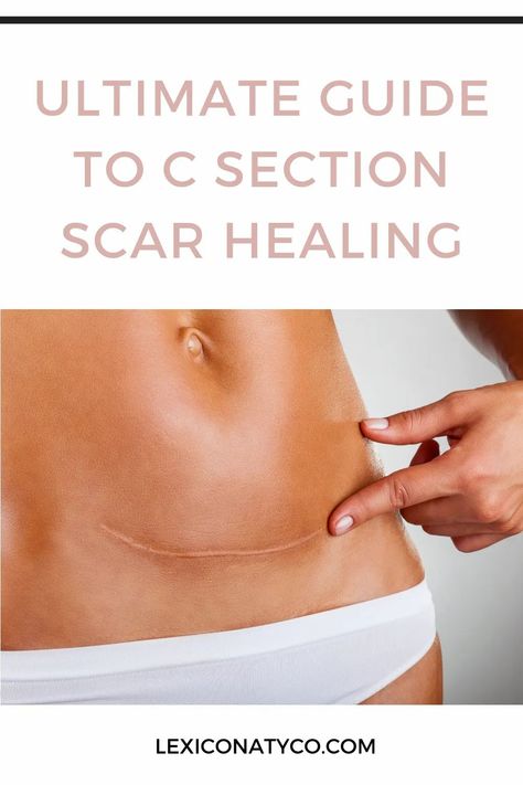 The ultimate guide to c section healing, incision care, recovery tips and insight into why you might feel numbness and itching around your scar! #csectionrecoveryessentials #csectiontips #csectionscarhealing #csectioncare #newmom C Section Scar Healing, C Section Healing, Feel Numbness, Healing From C Section, Maternity Nurse, C Section Scar, Scar Healing, Newborn Necessities, Postpartum Exercise