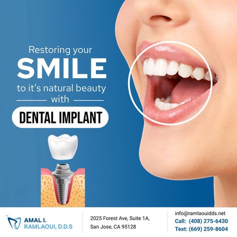 Dental Implants Poster, Dentist Creative Ads, Dental Implants Creative Ads, Dental Poster, Dental Ads, Dental Implant, Dental Post, Dentist Social Media, Dental Wallpaper