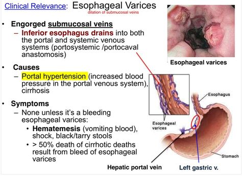 Flashcards GI Anatomy | Quizlet Gi Anatomy, Esophageal Varices, Nurse Ratchet, Nursing Knowledge, Anatomy Flashcards, Nursing 101, Nursing School Essential, Nursing Study Guide, Kidney Stone