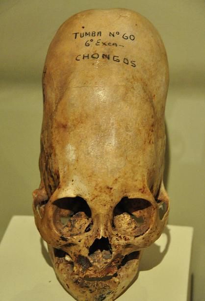 Deformed Skull, Elongated Skulls, Ancient Discoveries, Alien Skull, Real Skull, Dna Testing, Ancient Astronaut, Aliens And Ufos, Alien Creatures