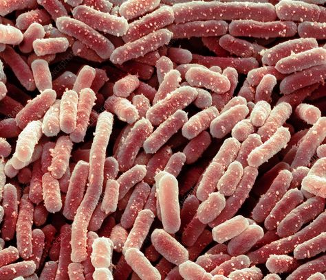 Lactobacillus bacteria, SEM - Stock Image - C020/7285 - Science Photo Library Lactobacillus Bacteria, Scientific Drawing, Mast Cell Activation Syndrome, Gastrointestinal Tract, Gut Flora, Healthy Food Choices, Health Diet, Ecosystem, Diet And Nutrition