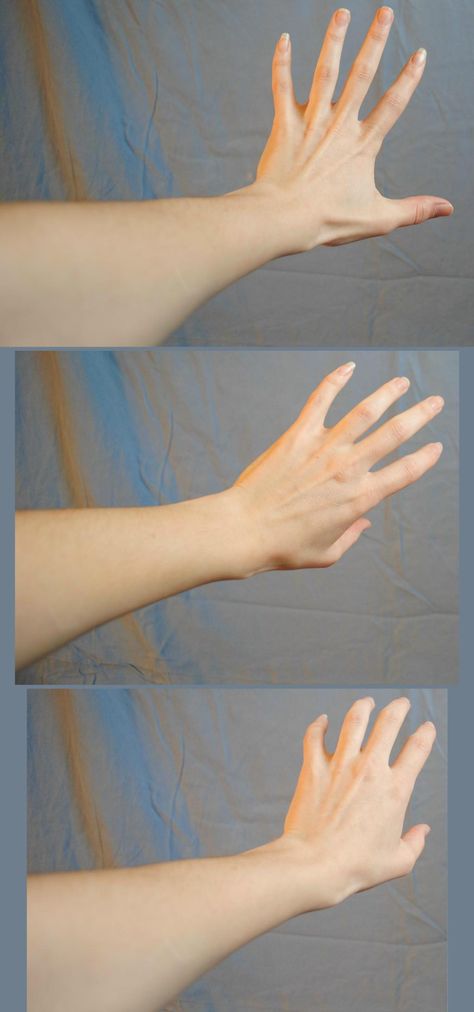 Arms Foreshortened Push by PirateLotus-Stock on DeviantArt Hand Anatomy, Hand Reference, Human Reference, Hand Pictures, My Journal, Face Reference, Anatomy Drawing, Body Reference, Anatomy Reference