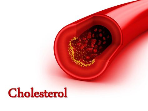 View and #Download Cholesterol, #PowerPoint #Presentation, give your #attractive #presentation with #ppt of Cholesterol. This #ppt presentation also use for other topics high cholesterol,chat is cholesterol,about cholesterol,#good and #bad cholesterol,#hdl cholesterol,#ldl cholesterol,cholesterol #counts,low cholesterol #diet. Naturally Lower Cholesterol, Foods To Lower Cholesterol, Wellness Foods, Foods To Reduce Cholesterol, Ways To Lower Cholesterol, What Is Cholesterol, To Lower Cholesterol, Cholesterol Symptoms, Cholesterol Lowering