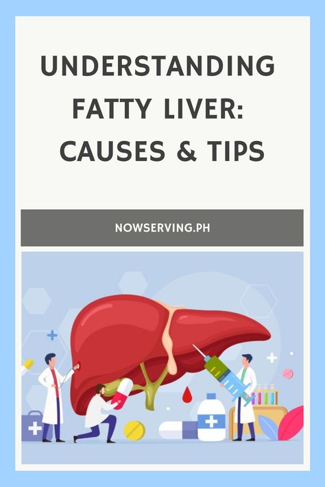 Illustration of medical professionals with an oversized liver, highlighting the theme of understanding fatty liver causes and tips. Enlarged Liver, Kidney Detox, Abdominal Discomfort, Liver Function, Liver Detoxification, Lack Of Energy, Healthy Liver, Liver Health, Fat Removal