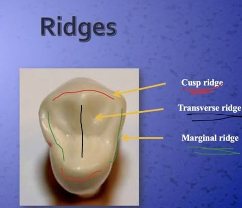 Dental Tooth Anatomy Dental Morphology, Tooth Morphology, Dental Nursing, Tooth Anatomy, Dental Assistant School, Dental Assistant Study, Dental Photos, Dental Hygiene Student, Dental Photography