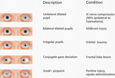 Emt Study, Nursing Study Tips, Nursing Fun, Nursing Cheat, Nursing Information, Nursing Assessment, Critical Care Nursing, Nursing School Studying, Nursing School Tips