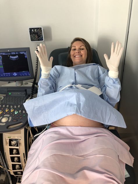 Maternal Assisted C-Section Birth - Lyz's Birth Story Crowning Birth Pictures, Big Pregnant, Birth Pictures, Mother To Be, Baby Life Hacks, Birth Center, Birth Story, Birth Stories, C Section