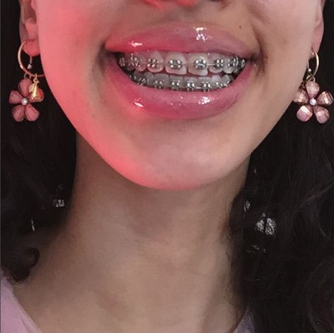 Pinterest:@Heyitssavxo Aesthetic Braces, Chain Braces, Brackets Aesthetic, Braces Aesthetic, Braces Ideas, Silver Braces, Power Chain, Dr Face, Cute Braces Colors