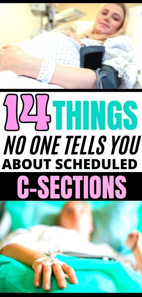 Prep For C Section, 2nd C Section Recovery, Postpartum After C Section, Plus Size C Section Recovery, Recovery From C Section, After Csection Recovery Tips, Second C Section, C Section Must Haves Recovery, C Section Preparation