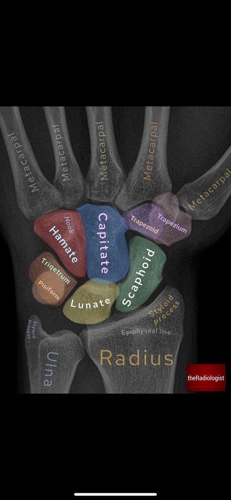 Radiography Aesthetic, Interventional Radiology, Tech Aesthetic, Rad Tech, Medical Studies, Human Anatomy And Physiology, Medical Anatomy, Medical Education, Radiology