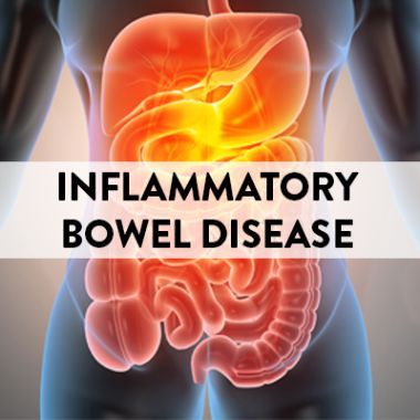 Inflammatory bowel disease can wreak havoc on the bowels, causing a variety of symptoms that can be different for everyone, and making it a difficult condition to diagnose. Learn more about IBD from the National Association For Continence. https://www.nafc.org/inflammatory-bowel-disease Crohns Symptoms, Ibd Symptoms, Crohns Diet, Irritable Bowel Disease, Inflammatory Bowel, Inflammation Causes, Disease Symptoms, Gi Tract, Irritable Bowel