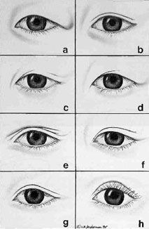 Types of Asian Eyelid 1 Monolid Vs Double Eyelid, How To Draw Hooded Eyes, Monolid Eyes Drawing, Hooded Eye Drawing, Hooded Eyes Drawing, Eyelids Drawing, Eyelid Types, Caucasian Makeup, Heavy Eyelids