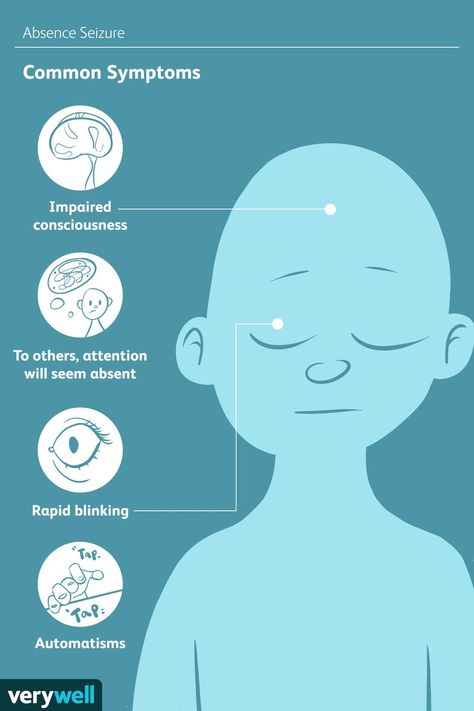 Focal Seizures, Absence Seizures, Types Of Seizures, Dravet Syndrome, Behavior Disorder, Developmental Delays, Neurological Disorders, Medical History, Sleep Deprivation