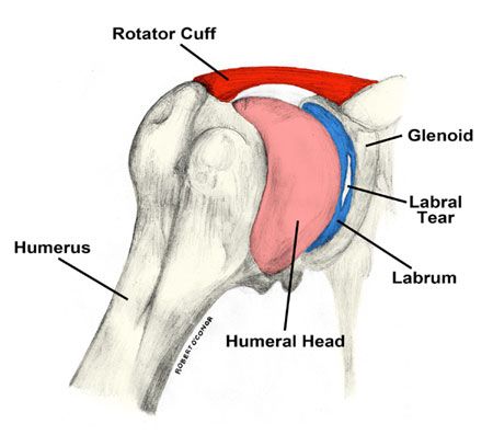 If you're looking at shoulder labral tear surgery pros and cons you need to make sure you don't have hidden shoulder instability that the surgeon missed! Torn Labrum Shoulder, Labral Tear Shoulder, Shoulder Surgery Recovery, Shoulder Rehab Exercises, Shoulder Anatomy, Rotator Cuff Surgery, Shoulder Dislocation, Shoulder Rehab, Rotator Cuff Tear