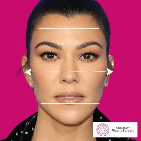 High Vs Low Cheekbones, Cheek Bones Makeup, Strong Cheekbones Woman, Highlight Cheek Bones, Low Cheekbones, Defined Cheekbones, Sagging Cheeks, Fat Transfer, Fat Grafting